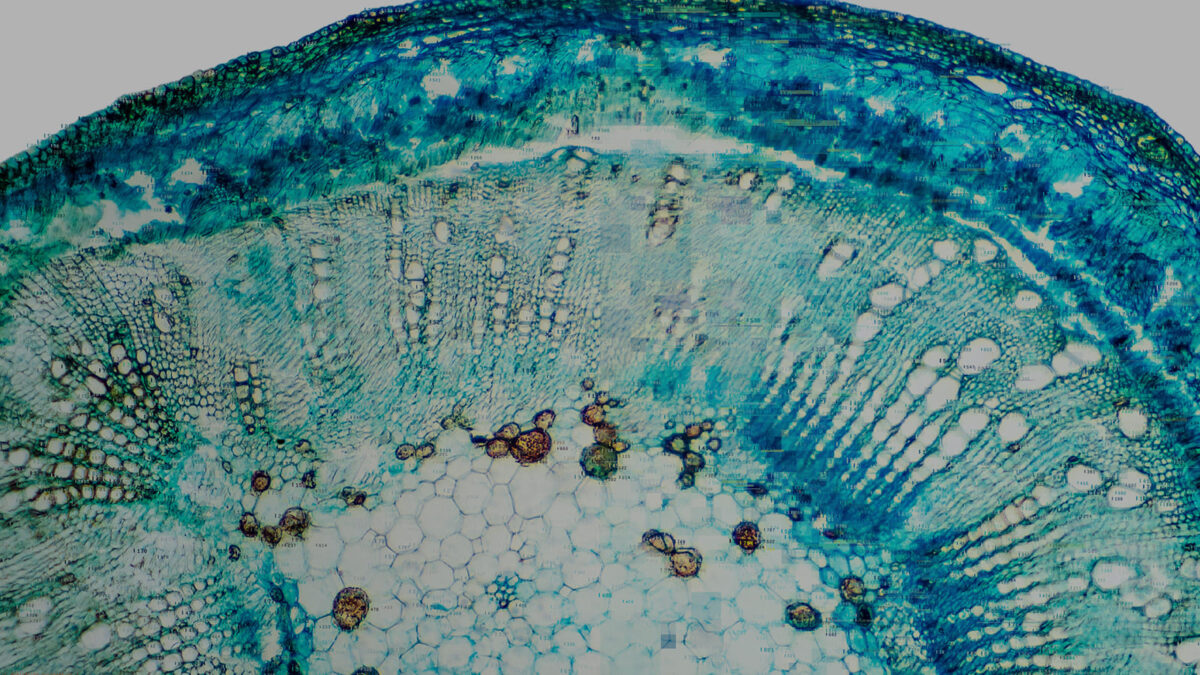 how-case-control-studies-enhance-real-world-evidence-key-methodologies